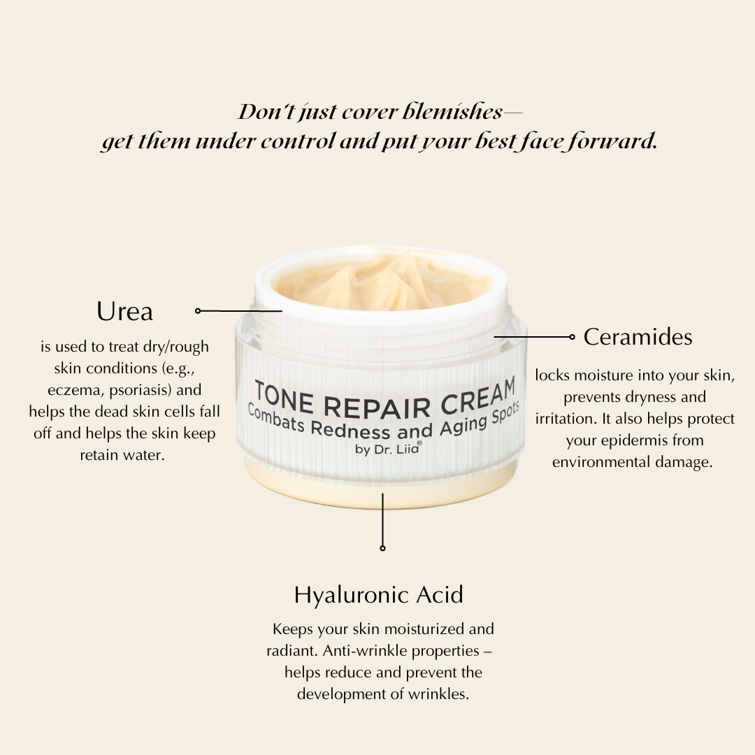 Brightening Face Cream for Redness &amp; Hyperpigmentation 